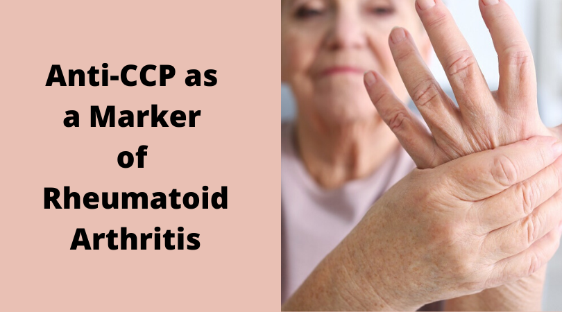 Anti-CCP as a Marker of Rheumatoid Arthritis